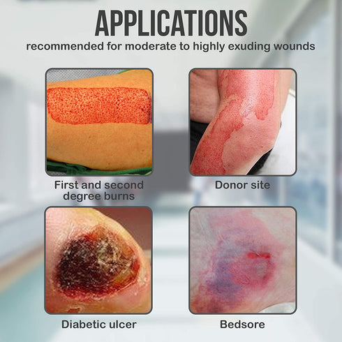 Silicone Foam Dressing 4”x8”